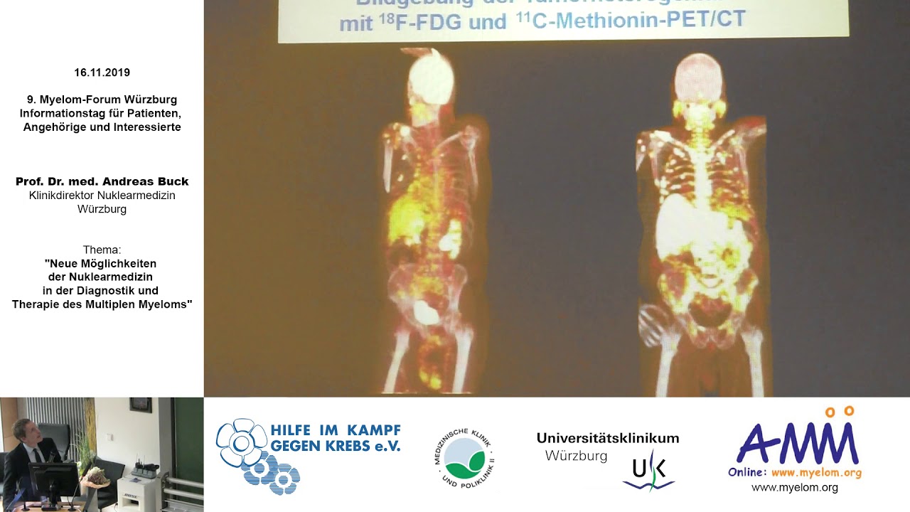 Möglichkeiten der Nuklearmedizin in der Diagnostik und Therapie