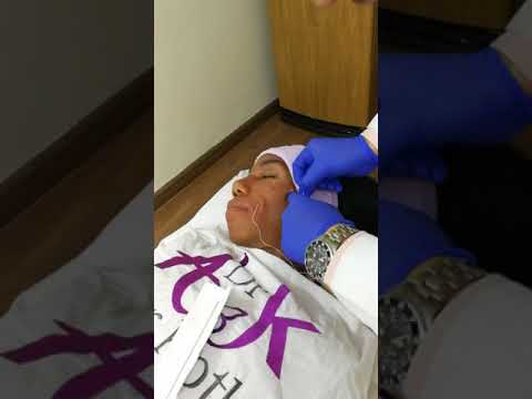 دكتور عمرو قطب Dr Amr Kotb شد الوجه بالخيوط الفرنسية