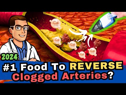 , title : '#1 Food to Clean out Your Arteries? [Blood Clots & Arteriosclerosis]'
