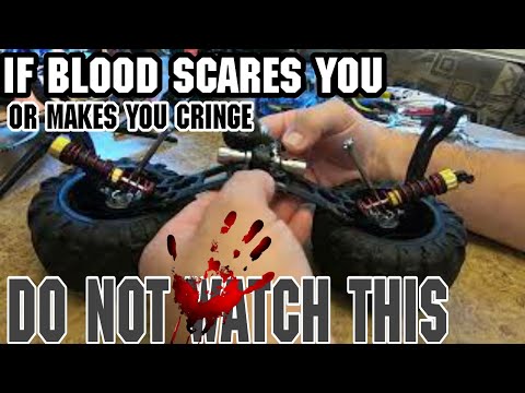 Hosim X07 Diff Repair