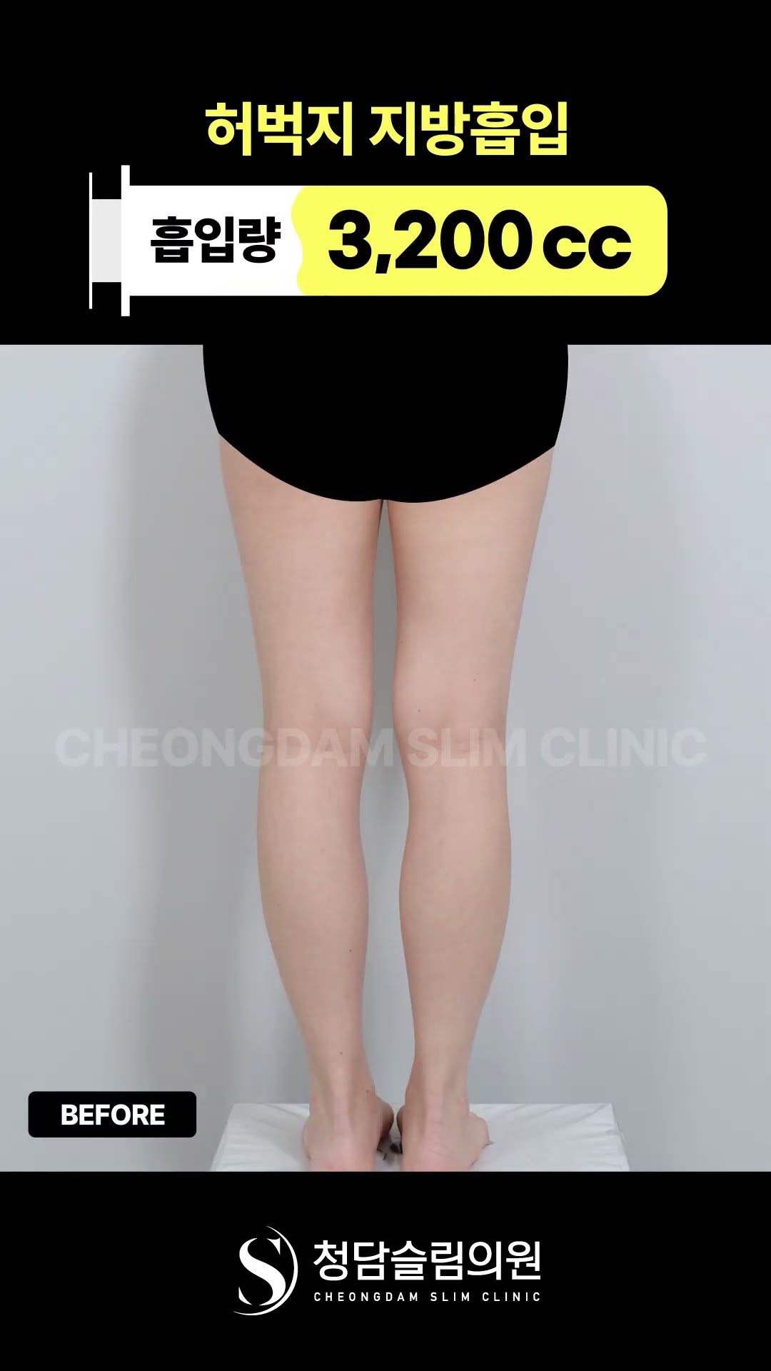  허벅지 하나만 집중해서 보면👀