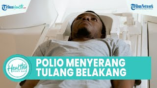 Pentingnya Kenal Penularan Virus Polio yang Dapat Menyerang Saraf Tulang Belakang, Ini Penjelasannya