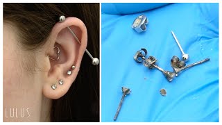 Removing  Gunky Tarnished Jewelry From Her Ear!! | S4 EP:23