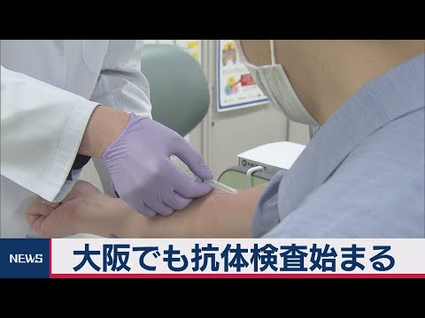 新型コロナ抗体研究開始:結果はこうして役立つ