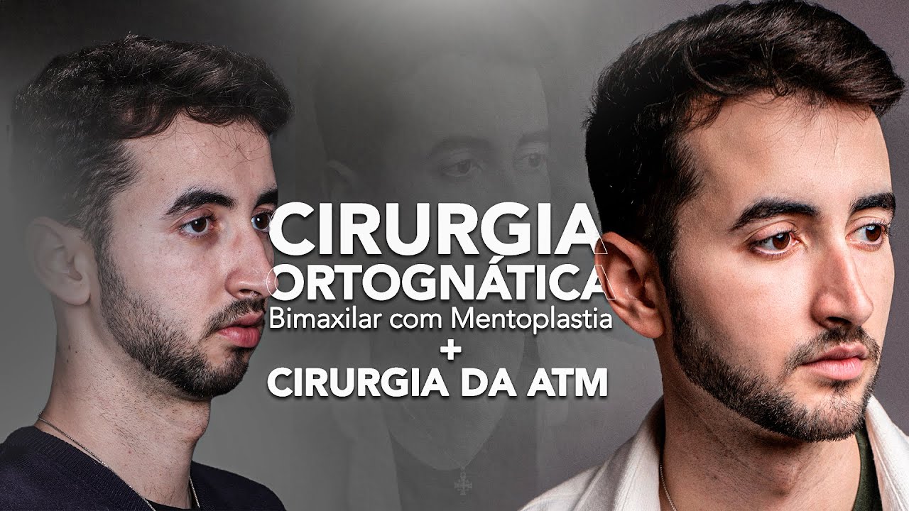 João Pedro Paulino Mazzon-79