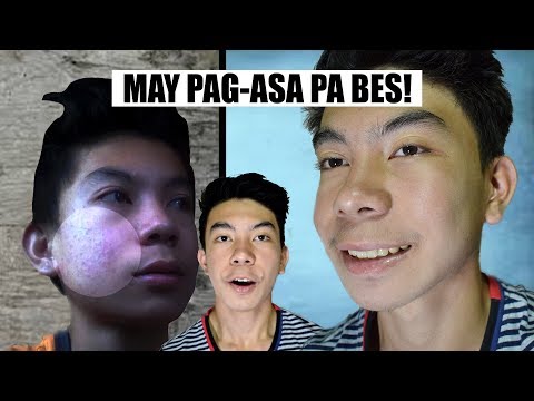 Fiona game losing weight Nangayayat Mischa Barton