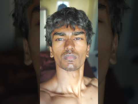 How I changed my face video out in my channel #facetransformation #looksmaxxing