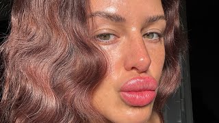 Come with me to get Botox 💉