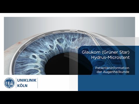 Glaukom (Grüner Star) – Hydrus-Microstent