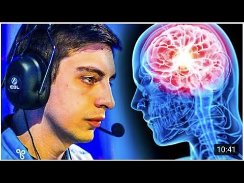 When Shroud Has 2000 IQ….