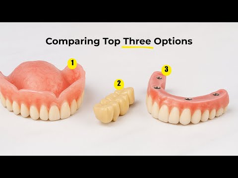 Comparing The Top 3 Options for Replacing Teeth