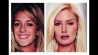 The Evolution of Heidi Montag: From Beauty to Barbie