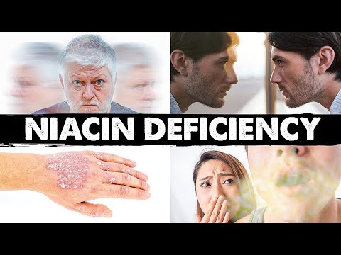 Spot Niacin (Vitamin B3) Deficiency Early with This Guide