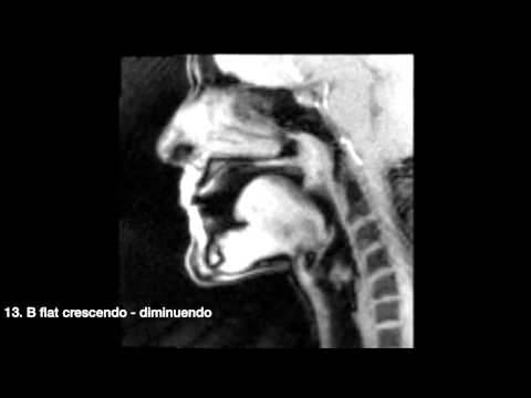 (MRI) Chamber Music with Sarah Willis