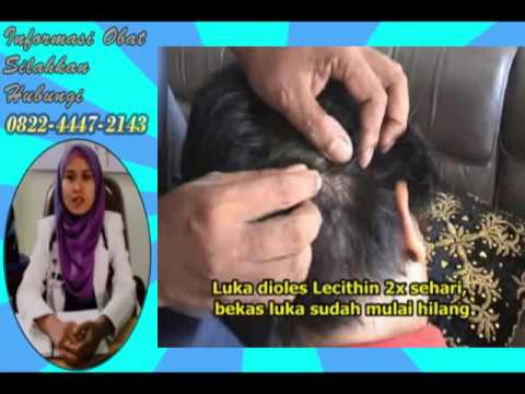 Bagaimana meningkatkan potensi obat Jahe dengan peningkatan potensi