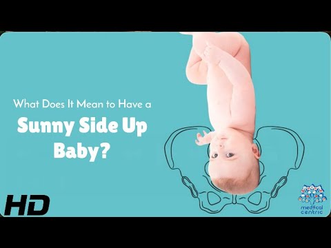 Sunny Side Up Baby: Signs, Risks & Delivery Tips!