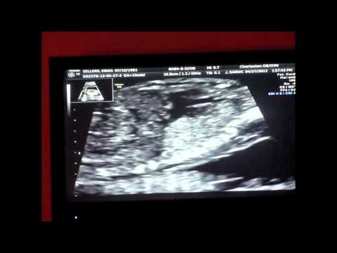 We're having a GIRL!