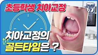 아이디올 아이디올