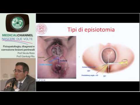 Stato neurologico nel osteocondrosi del toracica Rotazione del gomito