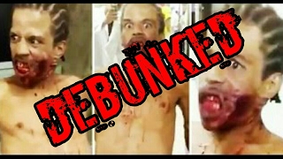 Terrifying Footage Shows ‘Possessed’ Man In Hospital After Being Shot In The Face DEBUNKED