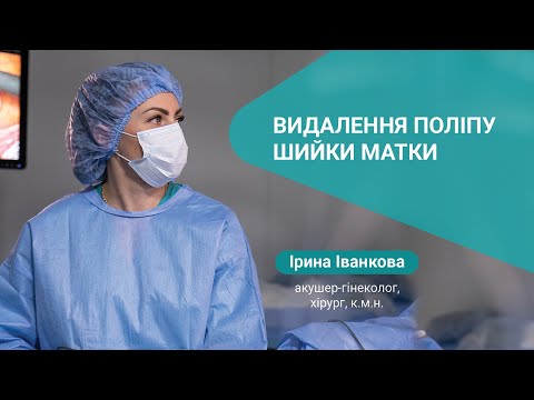 Видалення поліпу шийки матки