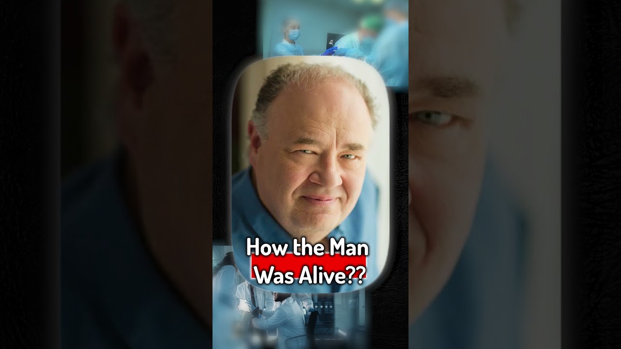 Man is Missing 90% of Brain, But Is Perfectly Normal 🤯🤯 #shorts