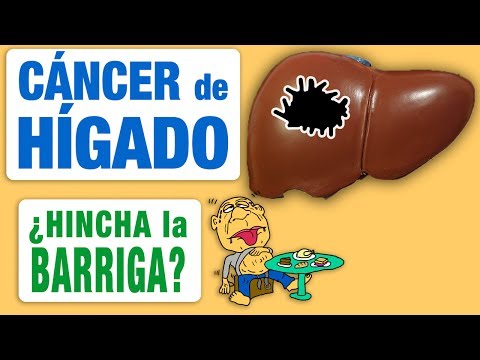 , title : 'El cáncer de hígado ¿nos hincha la barriga?'