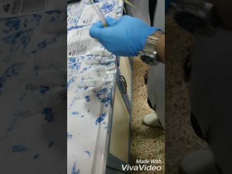 Chorus test ; toxo,CMV , Rubella