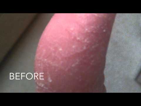 O'Keeffe's Working Hands Hand Cream, before and after pics