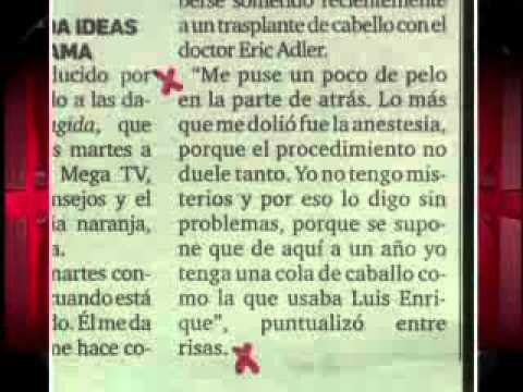 SuperXclusivo - Se añade pelo!