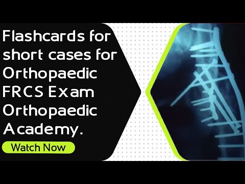 Flashcards for Short Cases for Orthopaedic Exams