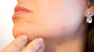 ЛЕЧЕБНЫЕ СВОЙСТВА ДЕГТЯРНОГО МЫЛА, ПОЛЬЗА ДЛЯ ЛИЦА И ТЕЛА