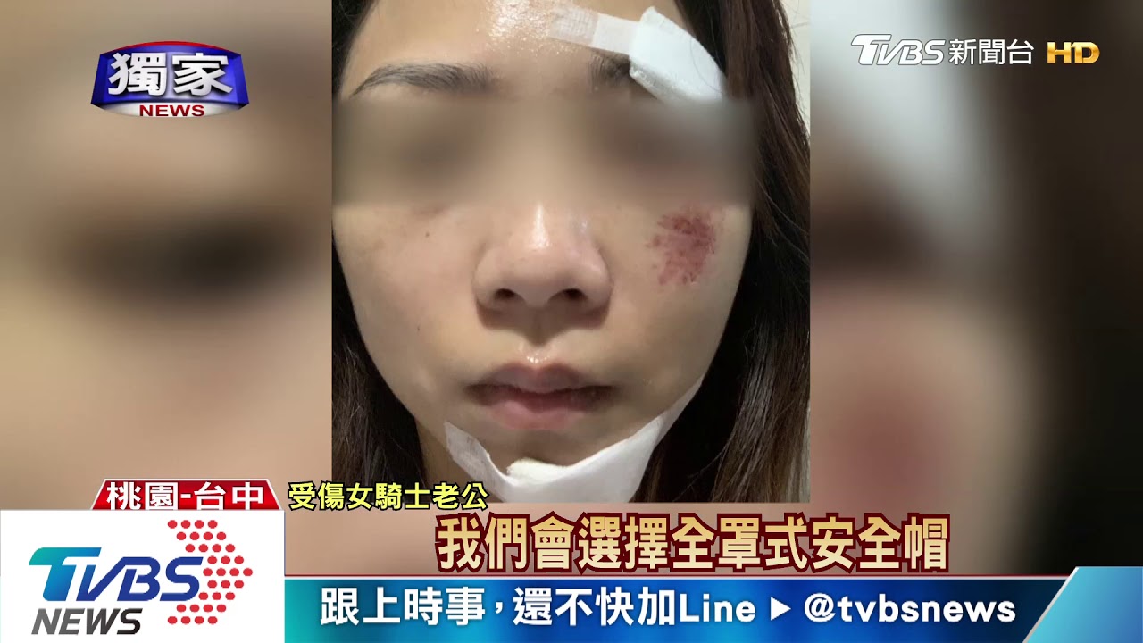 牙斷2顆下巴縫2針 戴半罩安全帽女慘摔