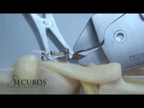 SECUROS University Tips & Tricks: Tensioning Device