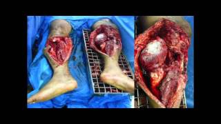 21st Silver Jubilee Oration | AIIMS (2015)
