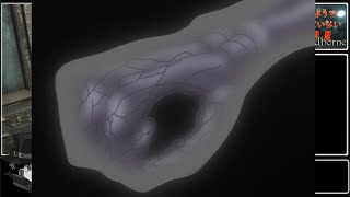 【ゆっくり実況】縛っているようで何も縛っていない輸血饅頭が初見ブラッドボーン【Bloodborne】part19
