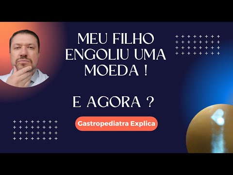 MEU FILHO ENGOLIU UMA MOEDA!!! E AGORA?