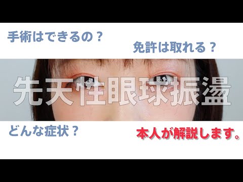 オピスト眼球について詳しく解説