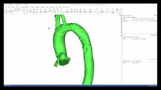 Tutorial: Automatic Vessel Segmentation Workflow
