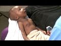 Breathing Problems Newborn Care Series