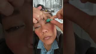 How to get rid of styes #stye #eyecaretips #eyecare #eyedoctor