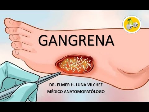 download lagu mp3 mp4 Gangrena, download lagu Gangrena gratis, unduh video klip Gangrena