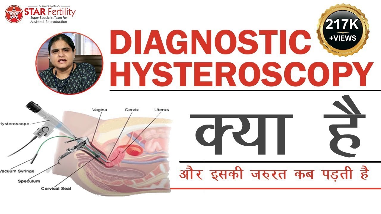 Diagnostic Hysteroscopy and Diagnostic Laparoscopy #ivf punjab #ivf in punjab #best ivf # test tube