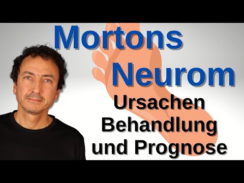 Mortons Neurom – Ursachen, Behandlung und Prognose