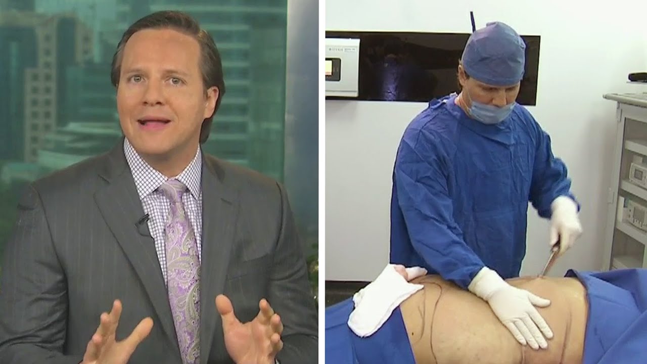 Watch Conoce la liposucción en 4D Now Conoce la liposucción en 4D