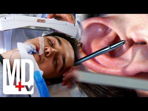 Ear Tick Almost Kills a Prodigy Son | Royal Pains | MD TV