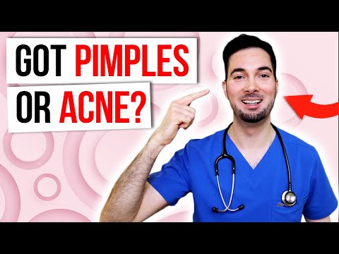 How To Get Rid Of Stretch Marks Removal and Treatment