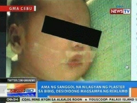 Potasa permanganeyt na may suka paggamot ng kuko halamang-singaw Mikozan presyo sa lawa pharmacy