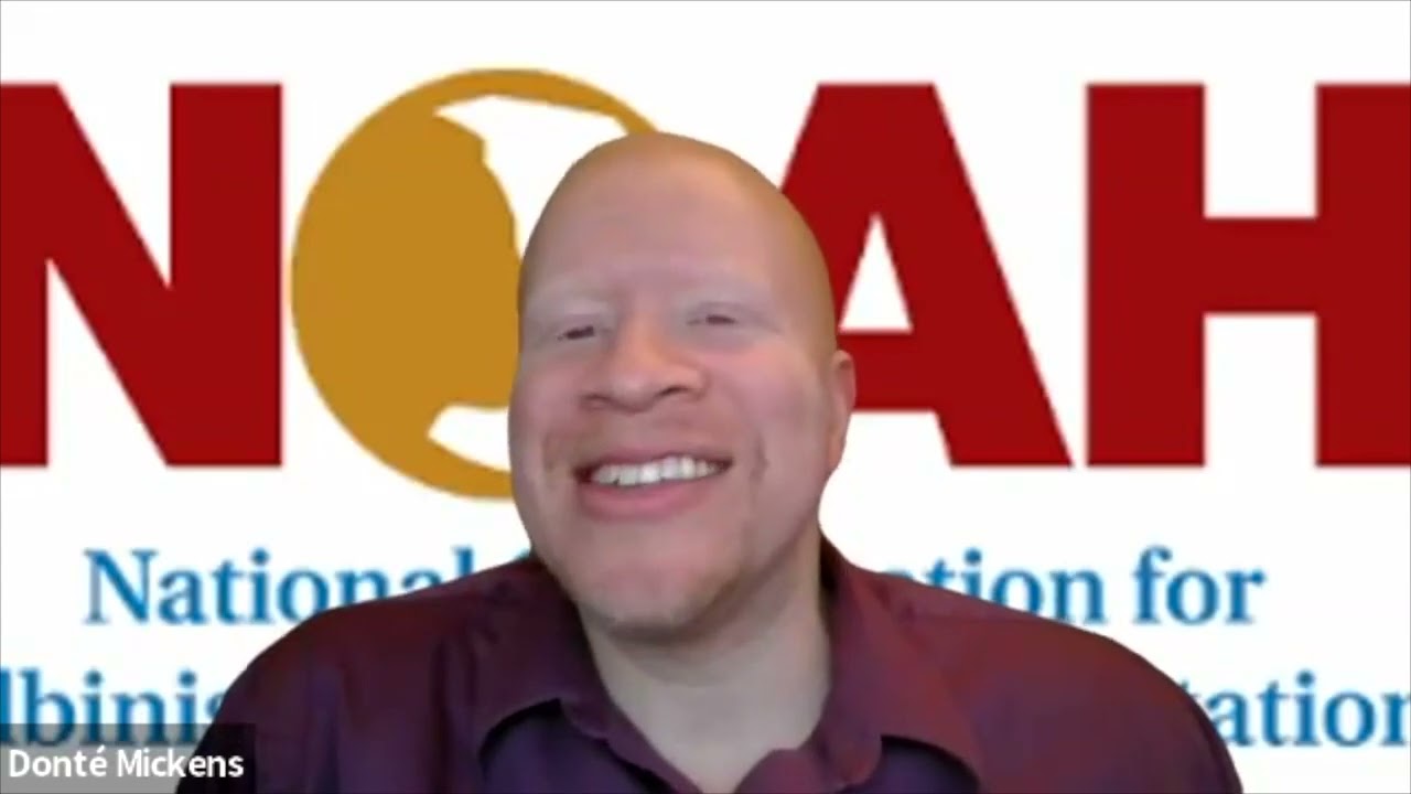 Share Your Story: Living with Albinism - An Interview with James Morehead