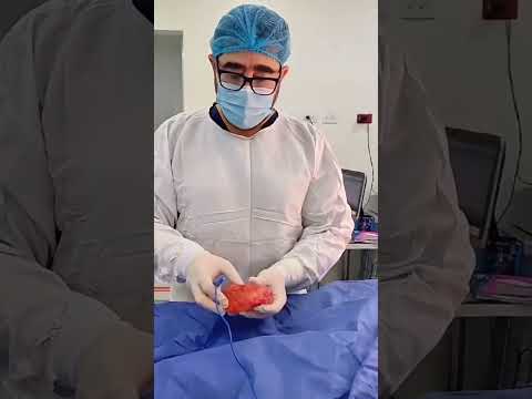 video MZC7Zerpm7I